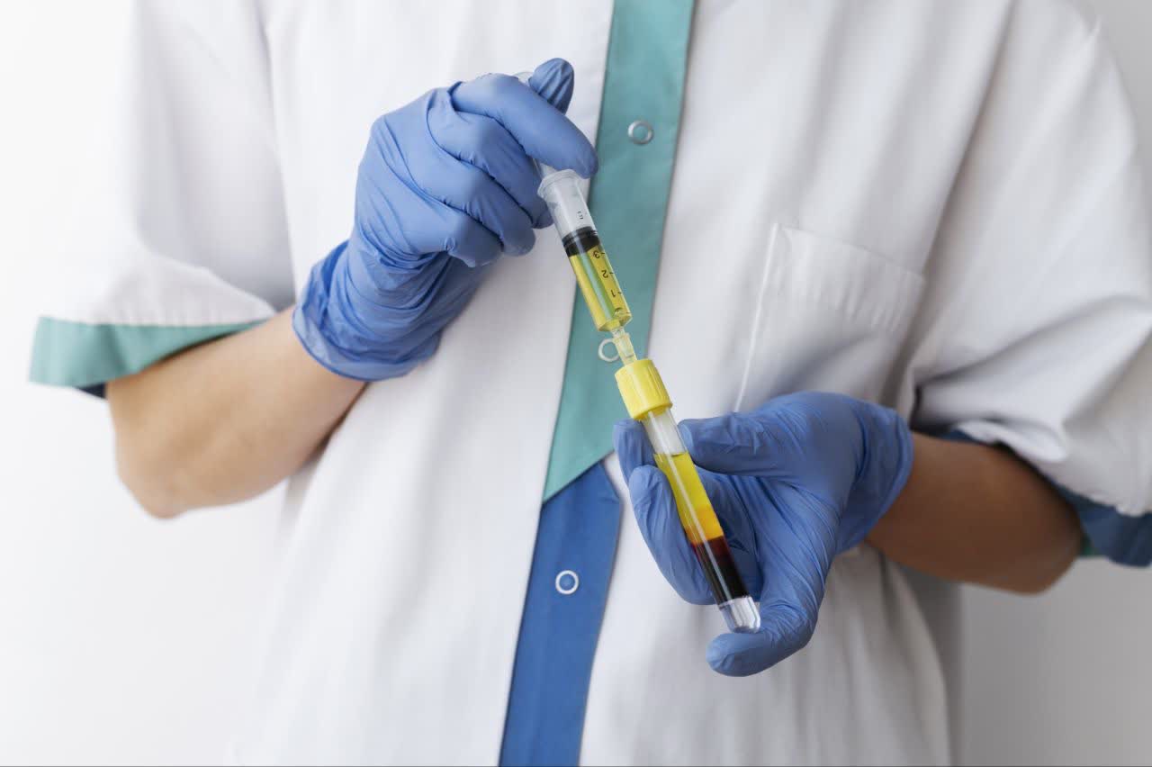 تزریق PRP