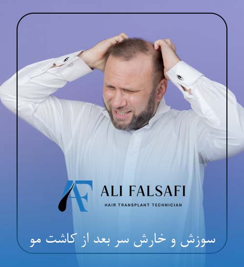 سوزش و خارش سر بعد از کاشت مو
